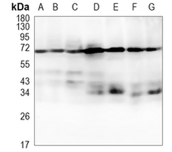 ALPL Rabbit Monoclonal Antibody