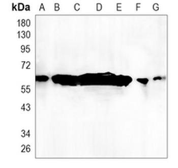 Cytokeratin 9 Rabbit Monoclonal Antibody