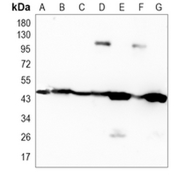 CD142 Rabbit Monoclonal Antibody