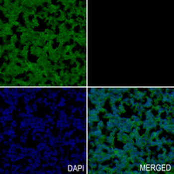 CD142 Rabbit Monoclonal Antibody