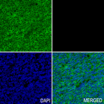 TIP-1 Rabbit Monoclonal Antibody