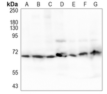 SDHA Rabbit Monoclonal Antibody