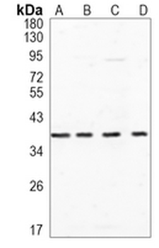 NSDHL Rabbit Monoclonal Antibody