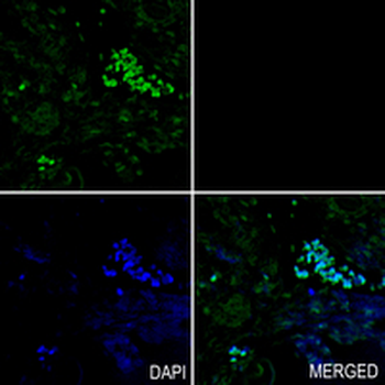 STAG2 Rabbit Monoclonal Antibody