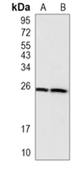 ARFRP1 Rabbit Monoclonal Antibody