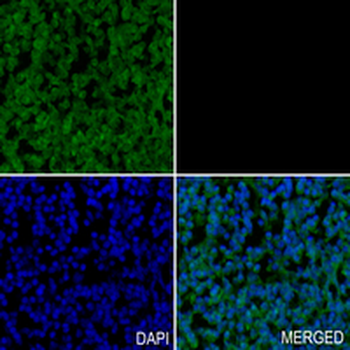 ARFRP1 Rabbit Monoclonal Antibody
