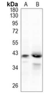 NCK2 Rabbit Monoclonal Antibody