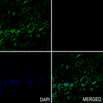 SCP2 Rabbit Monoclonal Antibody
