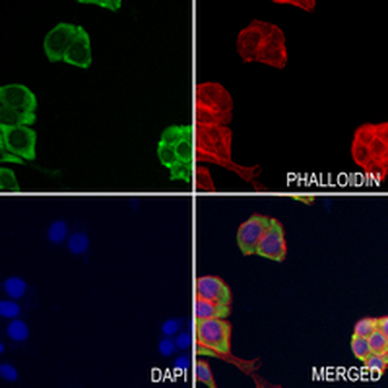 SCP2 Rabbit Monoclonal Antibody