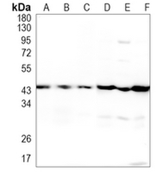 ACAT1 Rabbit Monoclonal Antibody