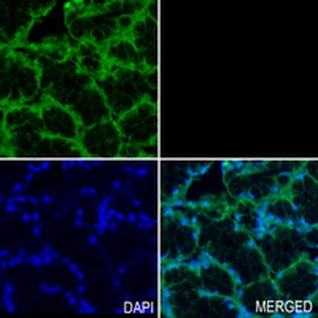 ACAT1 Rabbit Monoclonal Antibody