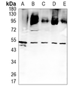 EGR2 Rabbit Monoclonal Antibody
