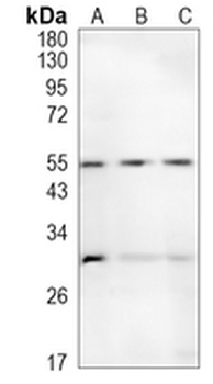 CD47 Rabbit Monoclonal Antibody