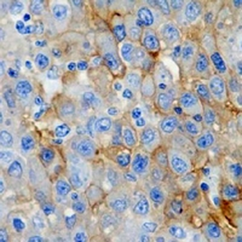 CD243 Rabbit Monoclonal Antibody