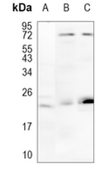 RhoA/B/C Rabbit Monoclonal Antibody