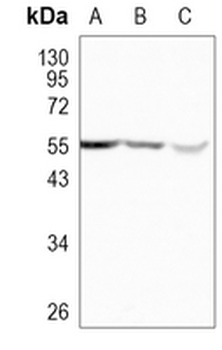 ENPP5 Rabbit Monoclonal Antibody