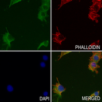 ENPP5 Rabbit Monoclonal Antibody