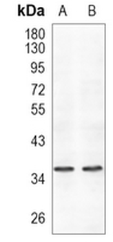 RNF115 Rabbit Monoclonal Antibody