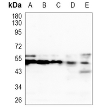 FADS1 Rabbit Monoclonal Antibody