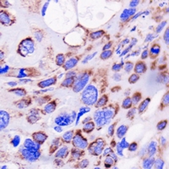FADS1 Rabbit Monoclonal Antibody