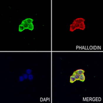 FADS1 Rabbit Monoclonal Antibody