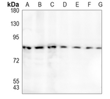 SATB2 Rabbit Monoclonal Antibody
