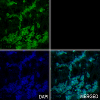 SATB2 Rabbit Monoclonal Antibody
