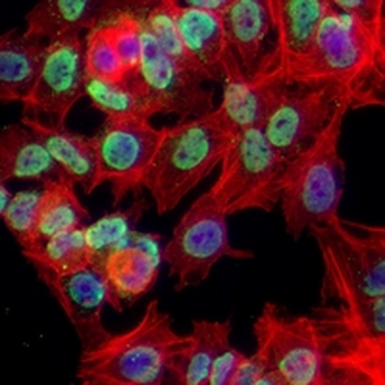c-Myc Rabbit Monoclonal Antibody