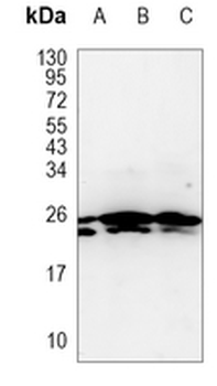 MRPS15 Rabbit Monoclonal Antibody