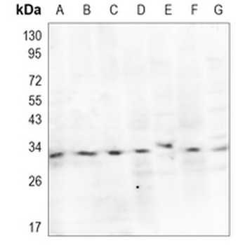 RYBP Rabbit Monoclonal Antibody