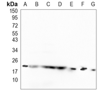 SRP19 Rabbit Monoclonal Antibody
