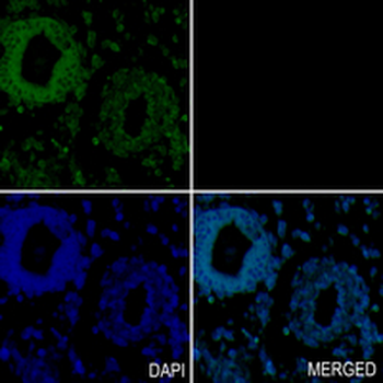 KIF5B Rabbit Monoclonal Antibody