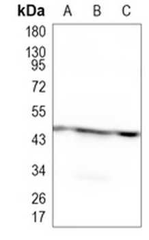 ELP4 Rabbit Monoclonal Antibody