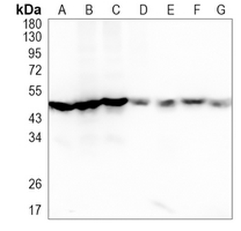ADSS Rabbit Monoclonal Antibody