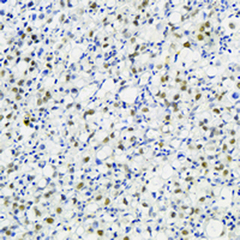 NAT10 Rabbit Monoclonal Antibody