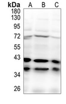 IgG4 Rabbit Monoclonal Antibody