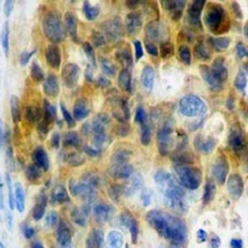 IgG4 Rabbit Monoclonal Antibody