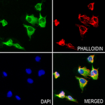 IgG4 Rabbit Monoclonal Antibody