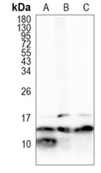 RNF7 Rabbit Monoclonal Antibody