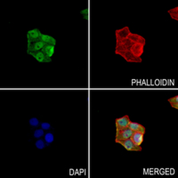 SMAD5 Rabbit Monoclonal Antibody