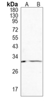 HHEX Rabbit Monoclonal Antibody