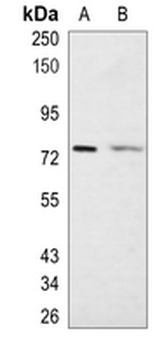 FUBP1 Rabbit Monoclonal Antibody