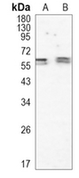 RGS6 Rabbit Monoclonal Antibody