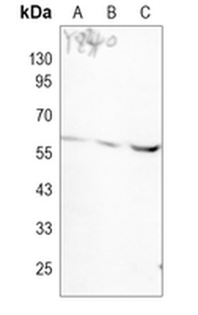 NLK Rabbit Monoclonal Antibody