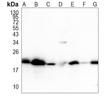 RAP1A/B Rabbit Monoclonal Antibody