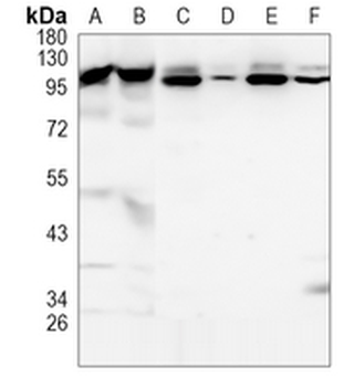 TNPO3 Rabbit Monoclonal Antibody