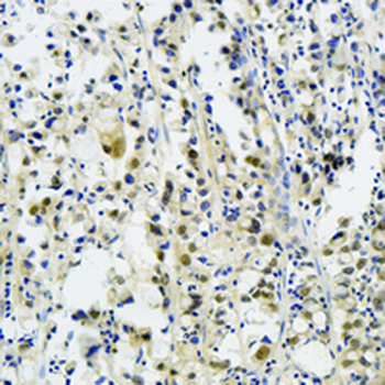 TNPO3 Rabbit Monoclonal Antibody