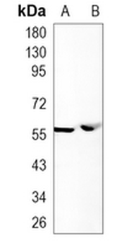 PTBP2 Rabbit Monoclonal Antibody