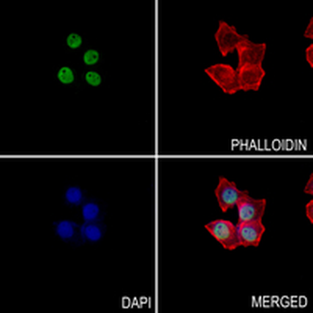 PTBP2 Rabbit Monoclonal Antibody