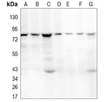 ALDH16A1 Rabbit Monoclonal Antibody